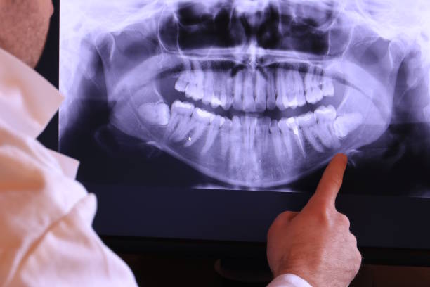 Best Broken or Cracked Tooth Emergency Dentist in El Verano, CA