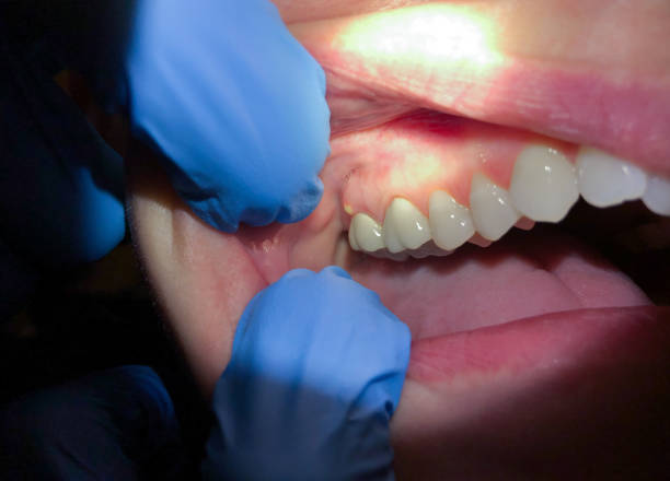 Best Emergency Dentist for Special Needs Patients in El Verano, CA