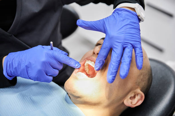 Best Emergency Dental Care for Abscessed Tooth in El Verano, CA